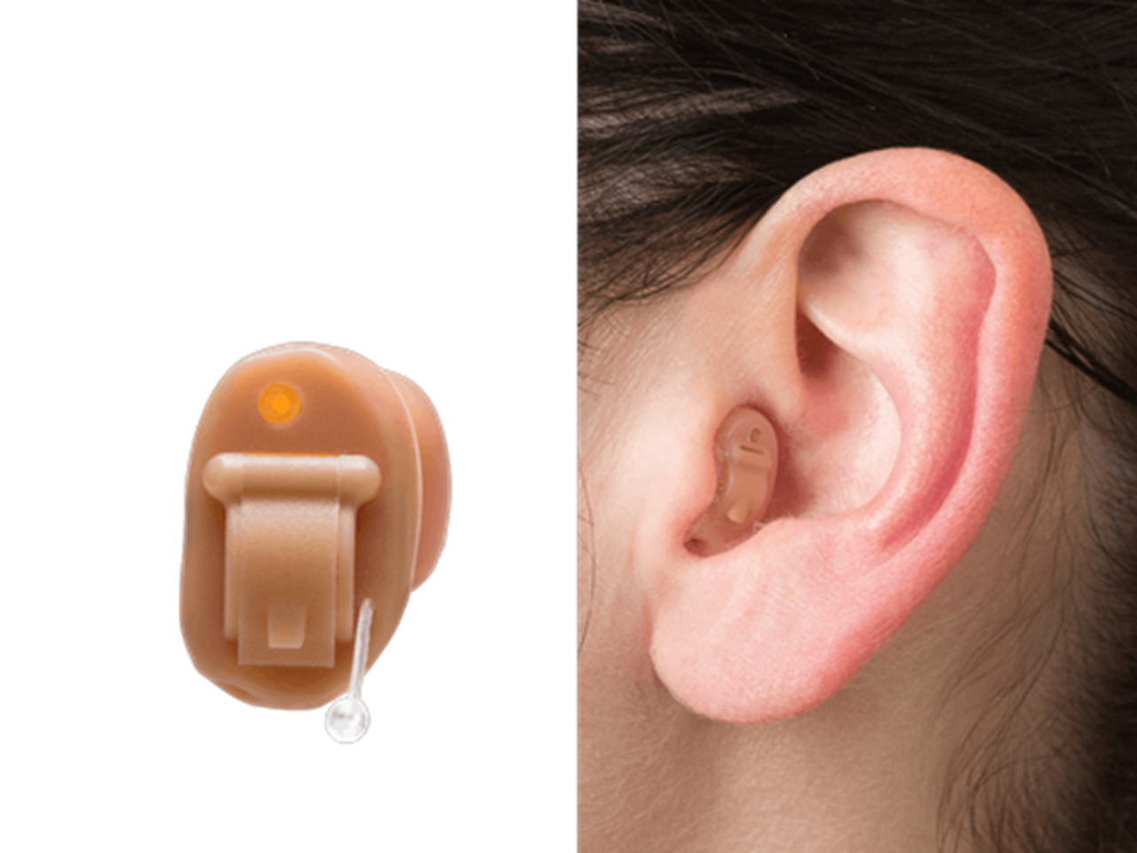 Come scegliere un apparecchio acustico: tipologie e problemi uditivi